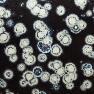 microscopic-mold_450x450-360x360