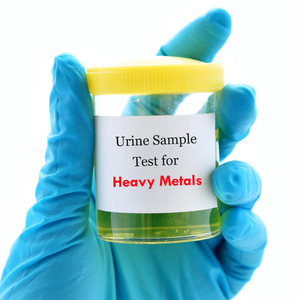 Identifying & Treating Heavy Metal Toxicities