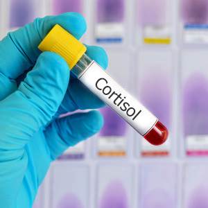 Interpreting Cortisol Lab Tests in Adrenal Fatigue